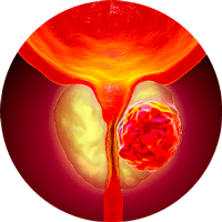 Sancılı süreçler