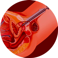 İktidarsızlık Şikayeti